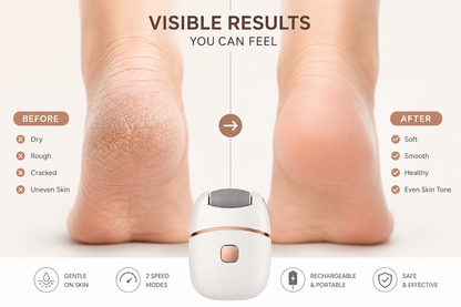 Oqva Foot Scrubber for Dead Skin & Women Callus Remover - Electronic Smooth and Soft Feet Scrubber Cracked Heels Remover Regular price