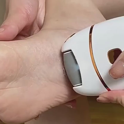 Oqva Foot Scrubber for Dead Skin & Women Callus Remover